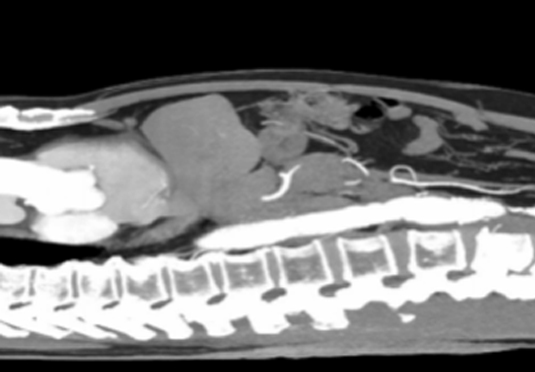 除外惡液質(zhì)晚期